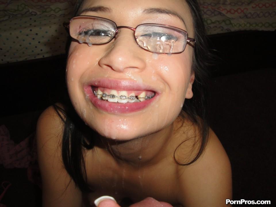 Naked Girl With Braces